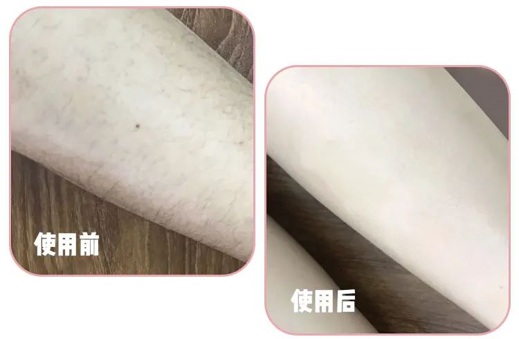 猕猴桃脱毛产品推荐,屈臣氏永久不再生毛的脱毛膏