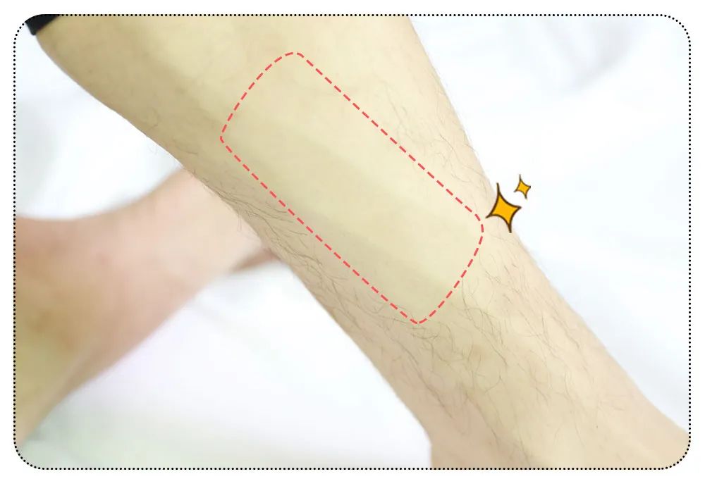 猕猴桃脱毛产品推荐,屈臣氏永久不再生毛的脱毛膏