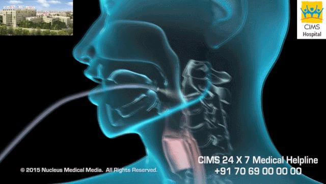 盘点医院各大科室侵入性检查：穿刺、内镜各显神通，小活检标本以“小”见“大”