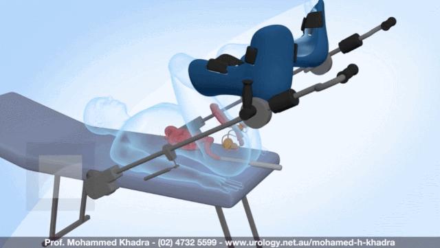 盘点医院各大科室侵入性检查：穿刺、内镜各显神通，小活检标本以“小”见“大”