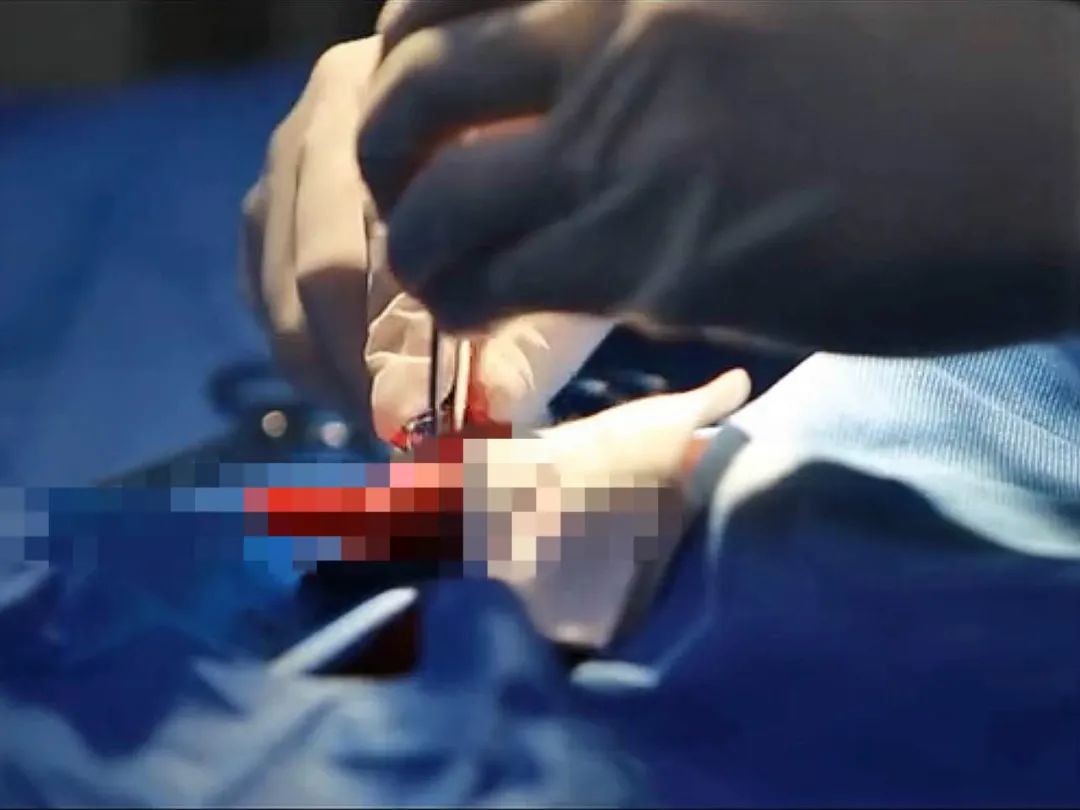 哪怕只有50%的机会，我还会毫不犹豫地跳下去……