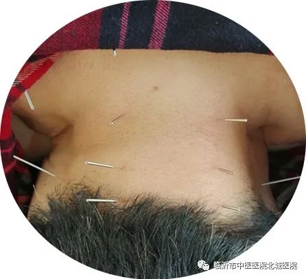 临沂市中医院医保门诊报销政策,不用医保也能报销的医院