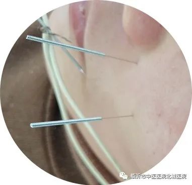 临沂市中医院医保门诊报销政策,不用医保也能报销的医院