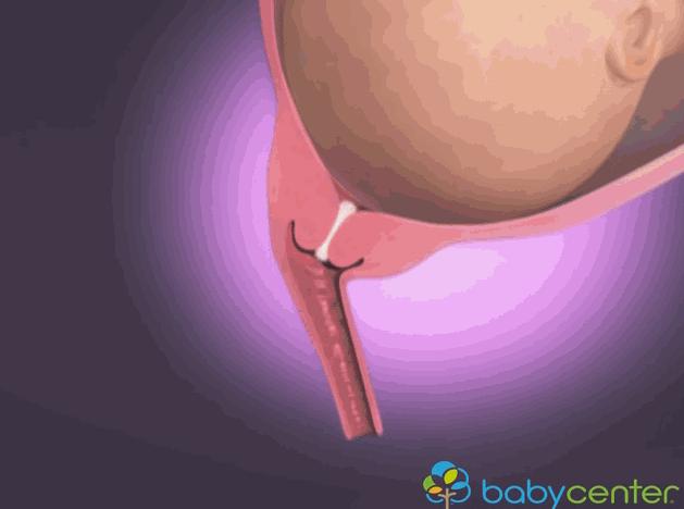 婴儿出生全过程3d演示,宝宝出生全过程纪录片
