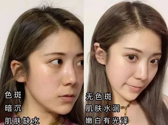 湿气不走，又胖又丑！睡前一贴，逼走体内20多年的湿寒，轻松甩掉失眠、大肚腩