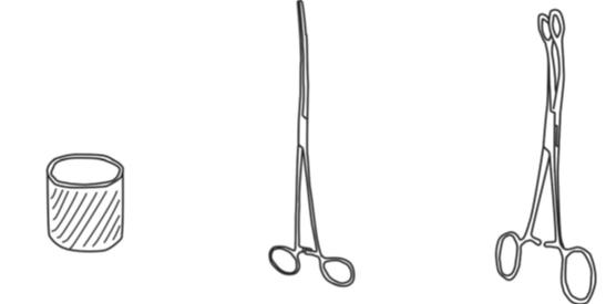 输卵管通液术手术配合,宫腔镜下输卵管通液术