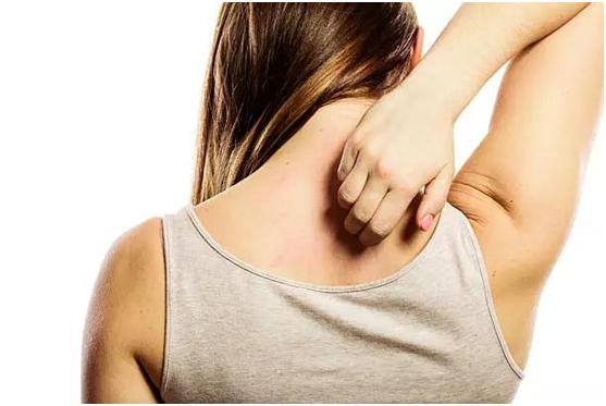 湿疹汗疱疹要关注什么,夏季皮肤湿疹关注事项