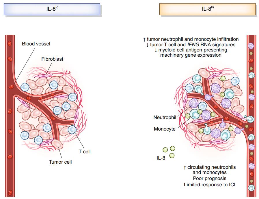 白介素对肿瘤细胞的影响,白介素8是促炎因子吗