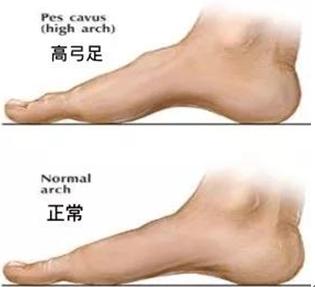 明明脚没有伤但脚还是疼为什么,脚底没有受伤但会痛是怎么回事
