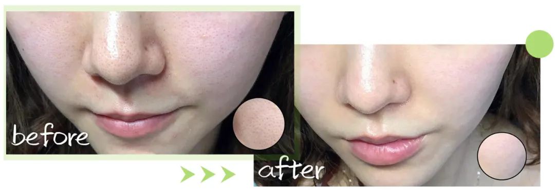 蜜诗肌酵素去角质凝胶,蜜诗肌酵素去角质