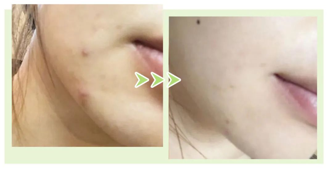 蜜诗肌酵素去角质凝胶,蜜诗肌酵素去角质