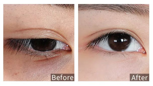 眼霜中的爱马仕！清爽不长脂肪粒，去黑眼圈效果秒2000元腊梅，亲测有效