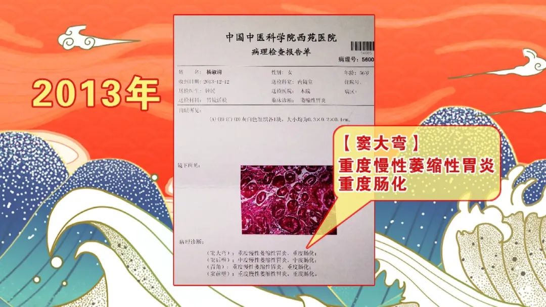 「养生堂」今日17:35播出《万病回春》里的治胃良方