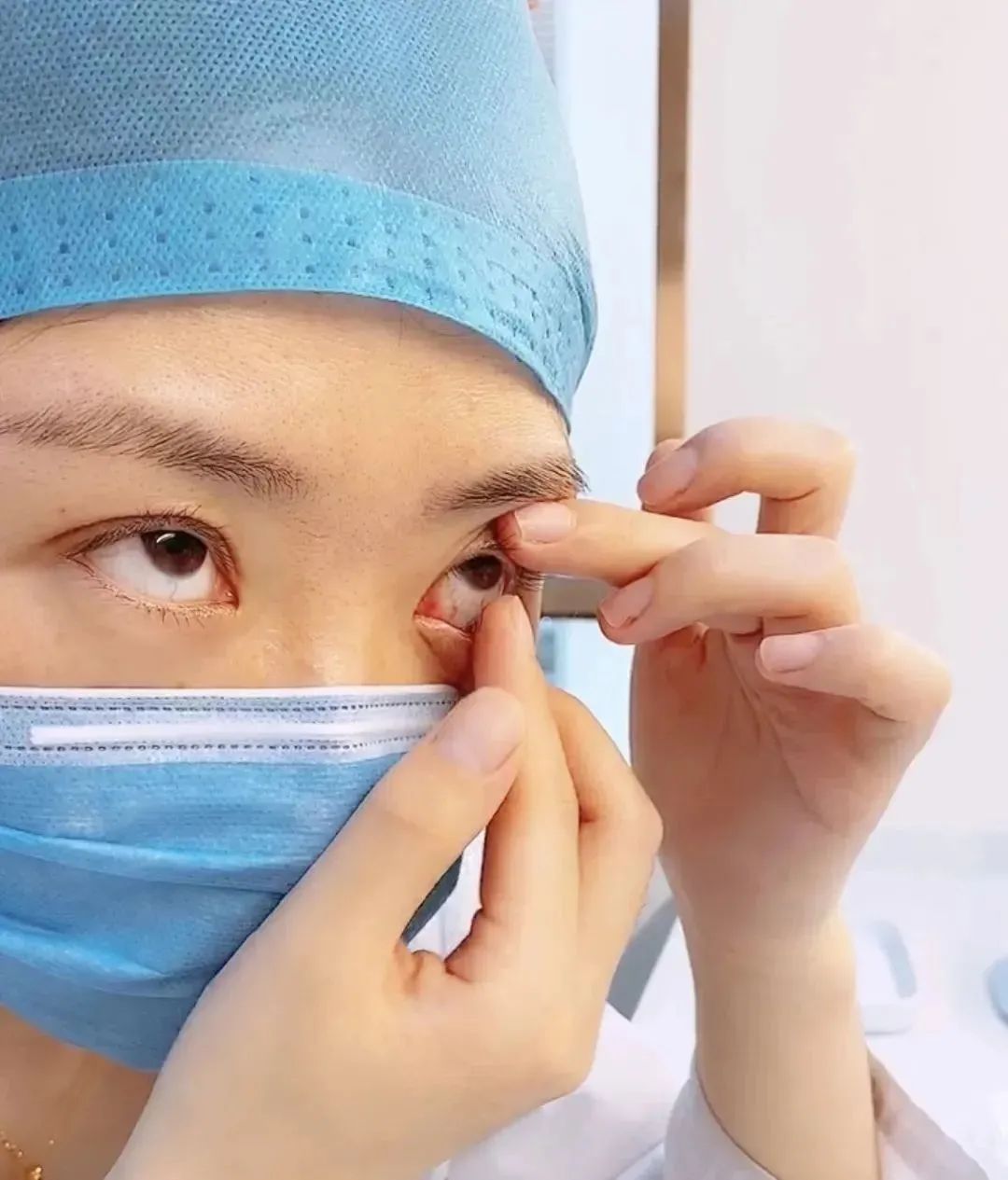 摘隐形眼镜有什么好方法吗,眼科怎么取隐形眼镜