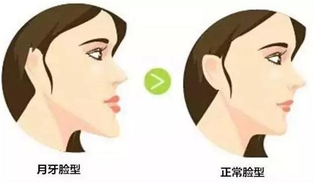 矫正牙齿有年龄限制吗,矫正牙齿的最好年龄是多少岁