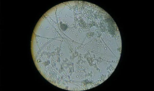 梅雨季节家里怎么除湿除霉小妙招,杭州梅雨季节防潮怎么处理