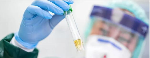 【今日钦州】钦州又一家医院可面向社会开展新型冠状病毒核酸检测