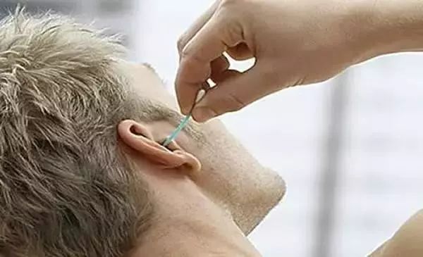 棉签抠耳朵导致癫痫,用棉签掏耳朵不小心被撞了一下