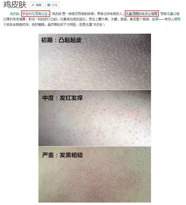 别放弃，烦人的“鸡皮疙瘩”，真的还可以再救一下