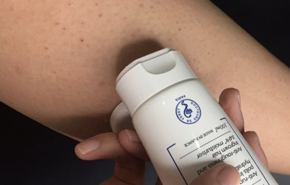 别放弃，烦人的“鸡皮疙瘩”，真的还可以再救一下