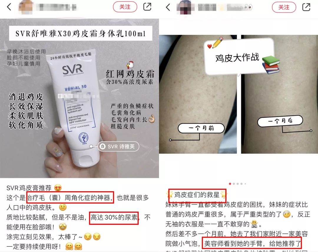 别放弃，烦人的“鸡皮疙瘩”，真的还可以再救一下