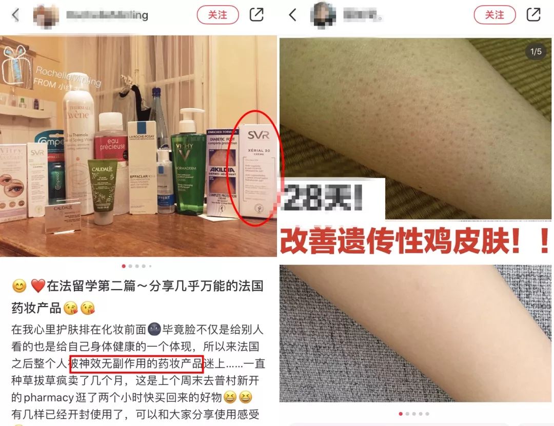 别放弃，烦人的“鸡皮疙瘩”，真的还可以再救一下