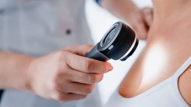 脸上长小肉揪揪用什么能抹下去,脸上长了能挤出来白色的东西