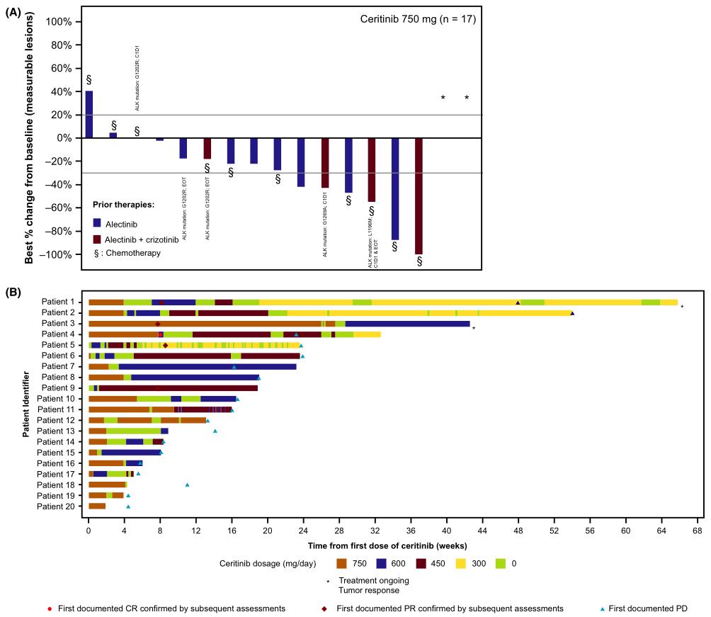 ascend研究,阿来替尼耐药后alk基因检测变阴性
