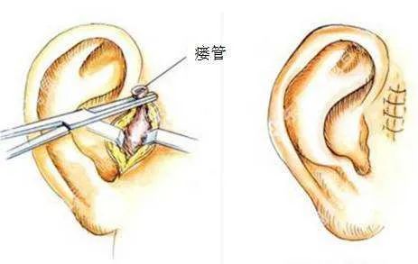 宝宝聪明洞,宝宝有聪明智慧