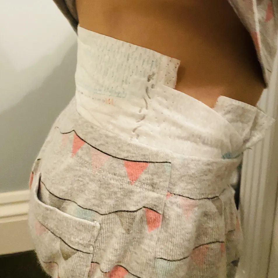 老人热天用什么尿不湿,天热了晚上穿尿不湿有什么好办法