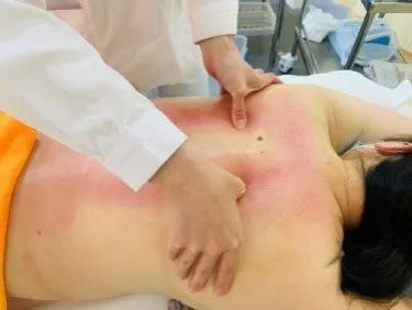 岳阳医院冬病夏治,中医养生保健冬病夏治