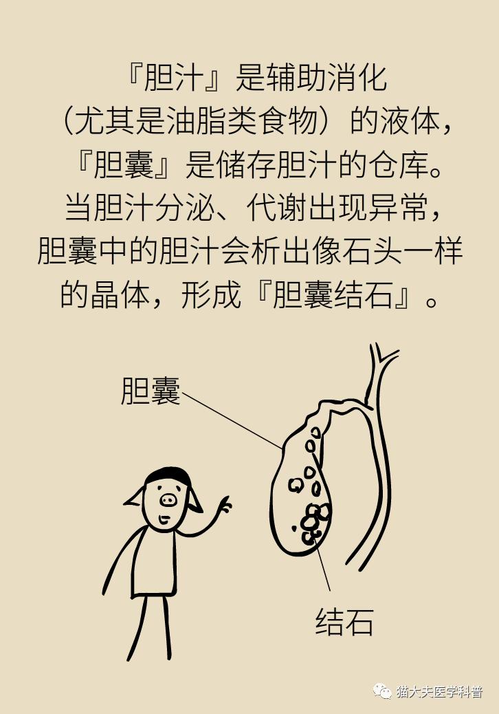 胆结石肝上也有结石怎么办,胆结石胆管里面有结石怎么办