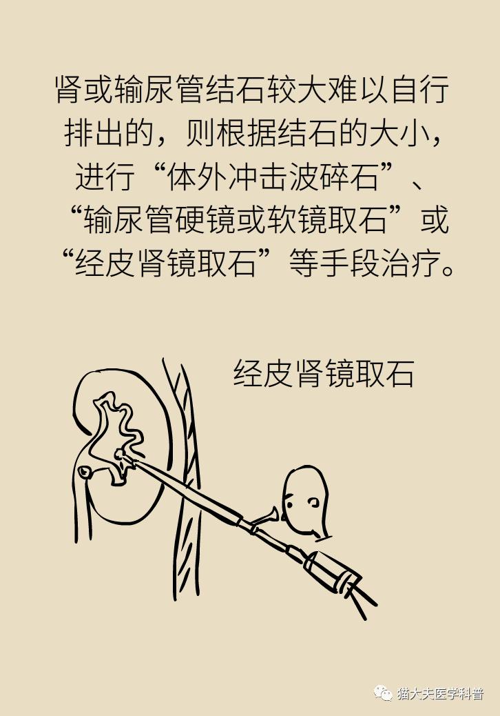 胆结石肝上也有结石怎么办,胆结石胆管里面有结石怎么办