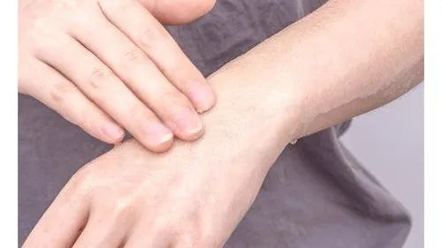 后背长痘快速消除小窍门,后背长痘一招搞定