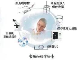 宫颈细胞学检查是怎么回事,宫颈细胞学检查di值超标