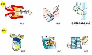 宫颈细胞学检查是怎么回事,宫颈细胞学检查di值超标