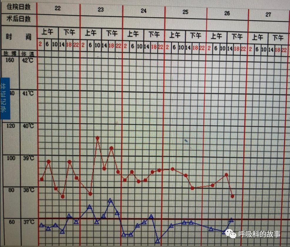五花八门的发热之一—药物热（1）
