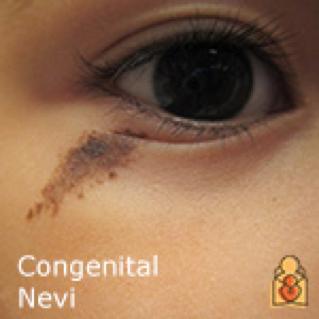 对号入座看看自己的痣,宝宝对号入座图片