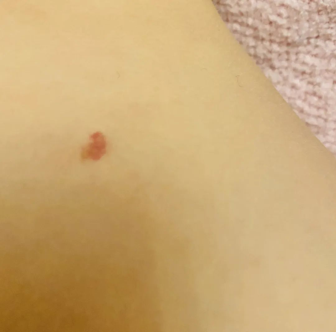 对号入座看看自己的痣,宝宝对号入座图片