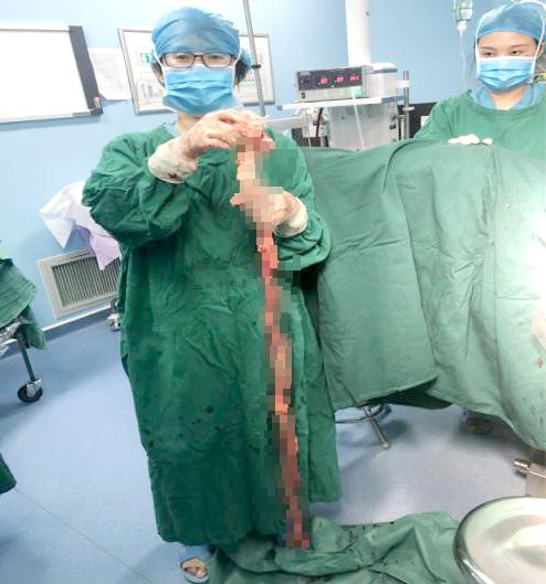 中年女士肚子大的跟怀孕一样,五岁小姑娘肚子突然变大了