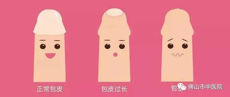 【干货】@家长，小孩包皮长这样该切，治疗的黄金时期是……