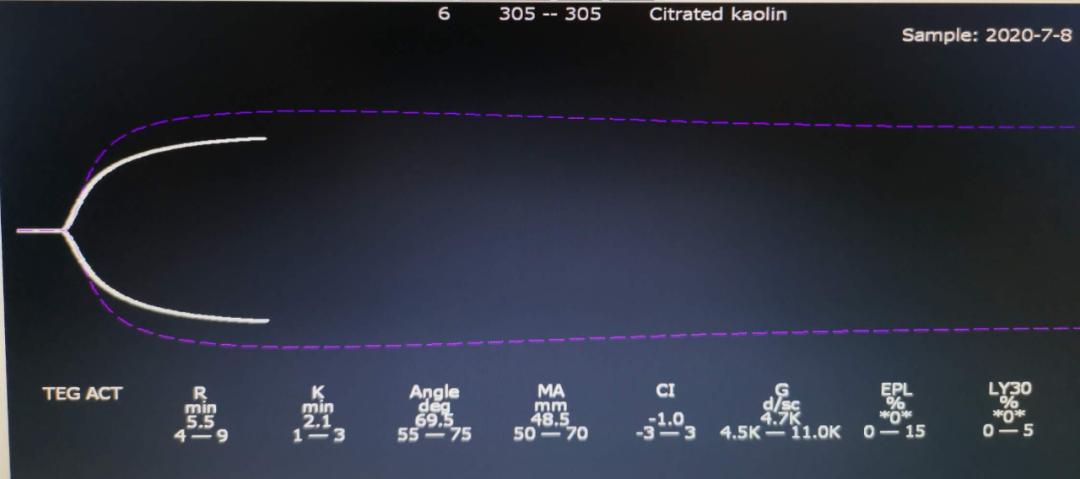 血栓弹力图和常规凝血四项区别,血栓弹力图试验凝血因子水平偏高
