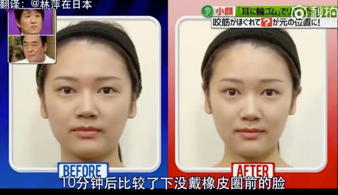 怎么在不动刀的情况下瘦脸,圆脸变瘦脸的方法不动刀