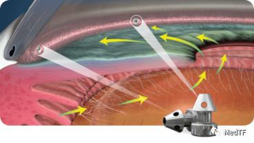 关注这八种药已经停售,关注这8种产品不要买