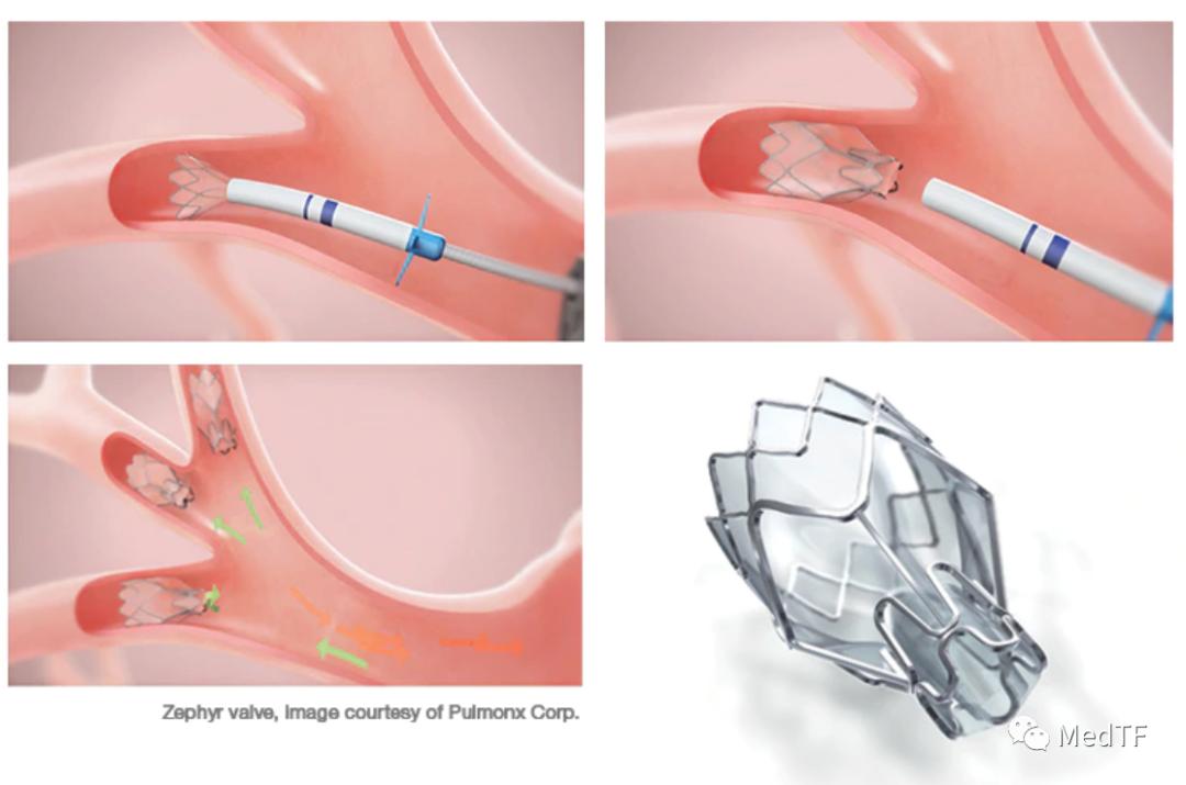 关注这八种药已经停售,关注这8种产品不要买