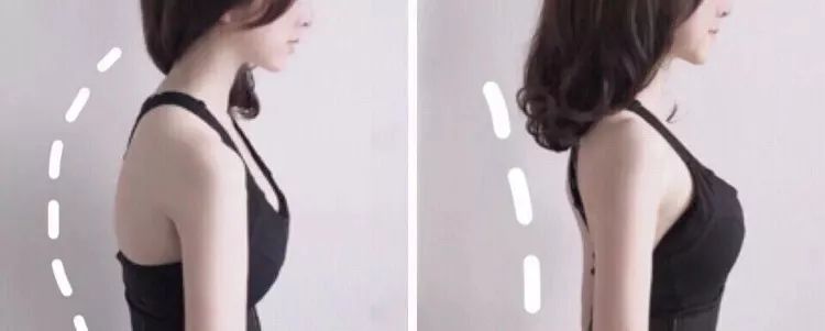 含胸驼背最损气质手把手教你纠正,含胸驼背如何改善提升气质