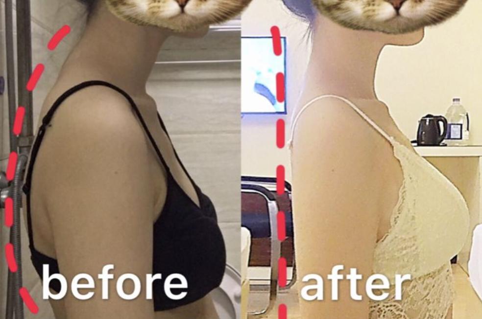 含胸驼背最损气质手把手教你纠正,含胸驼背如何改善提升气质