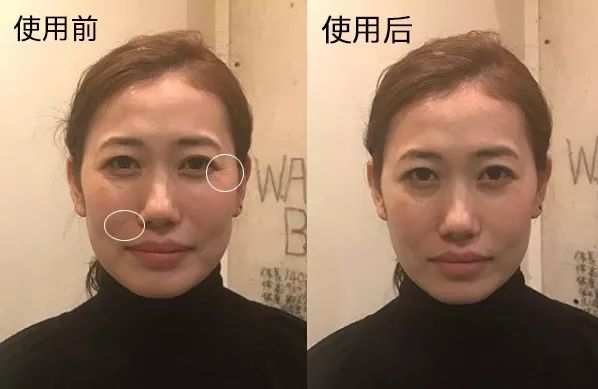 瘦脸小v脸的方法,每天张嘴闭嘴100下能瘦脸吗