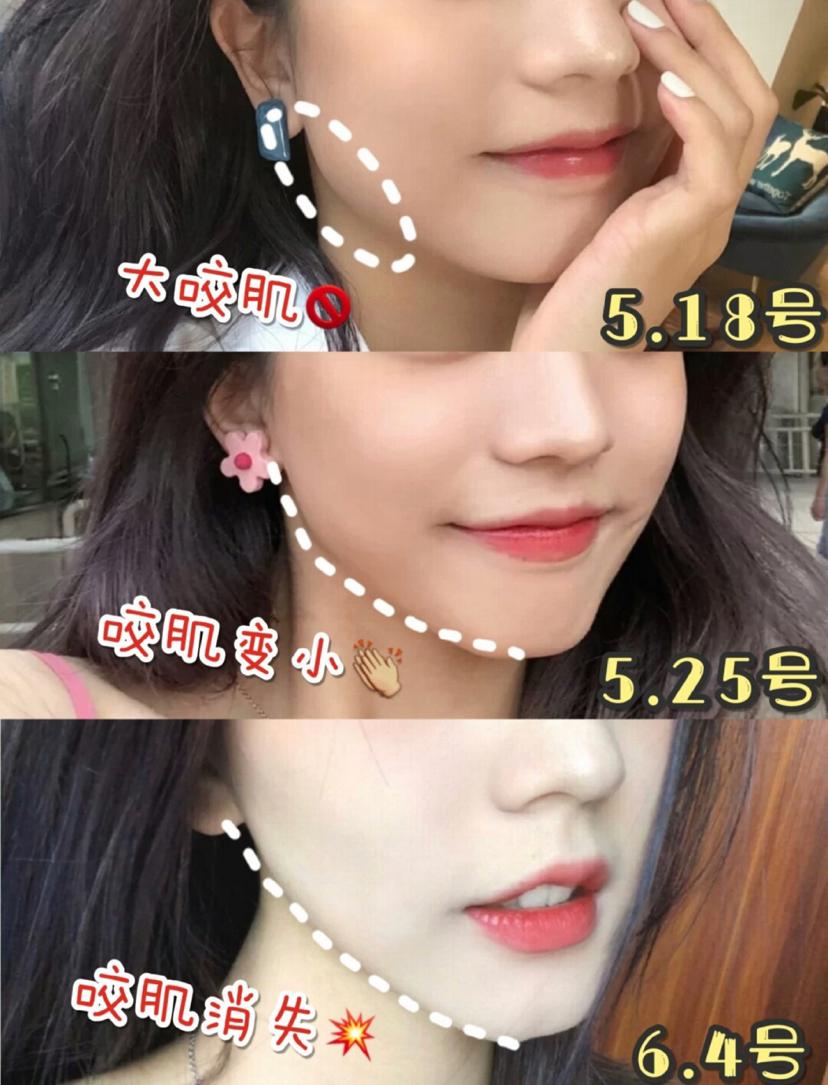 瘦脸小v脸的方法,每天张嘴闭嘴100下能瘦脸吗