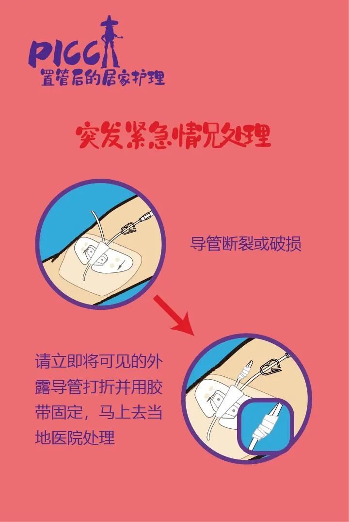 炎炎夏日您的爱车座椅通风了吗,周末picc去哪里维护